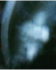 Ectoplasmic Mist Example